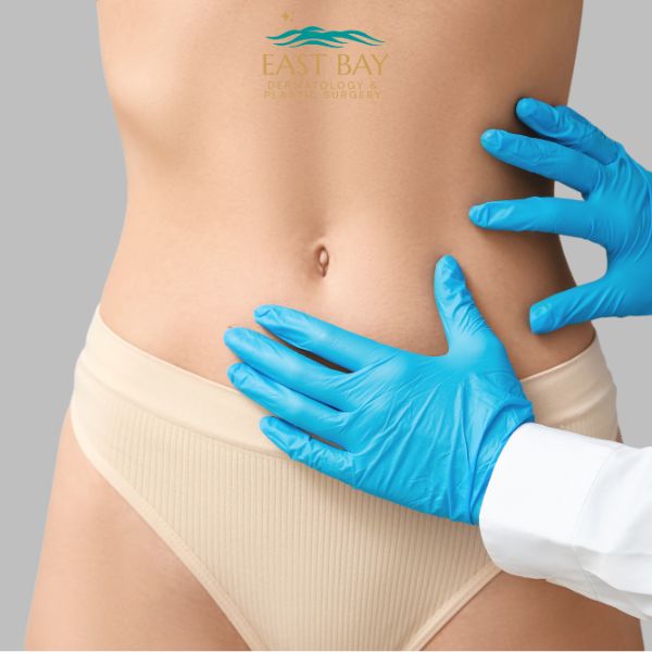 A person wearing beige underwear is examined by a medical professional in blue gloves, focusing on the abdomen. The East Bay Dermatology & Plastic Surgery logo is above.