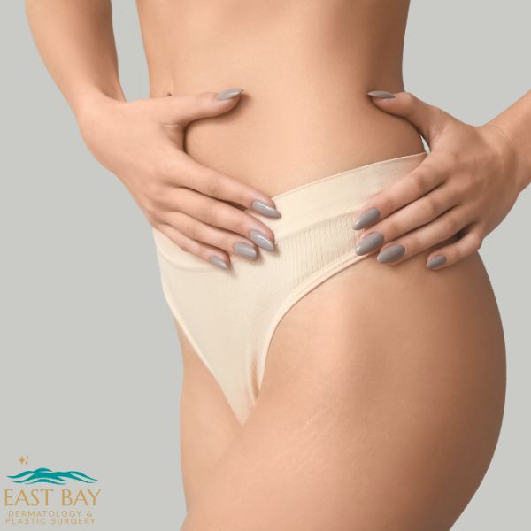 A woman wearing beige underwear holds her hands on her hips, displaying smooth skin. The East Bay Dermatology & Plastic Surgery logo is in the bottom left corner.