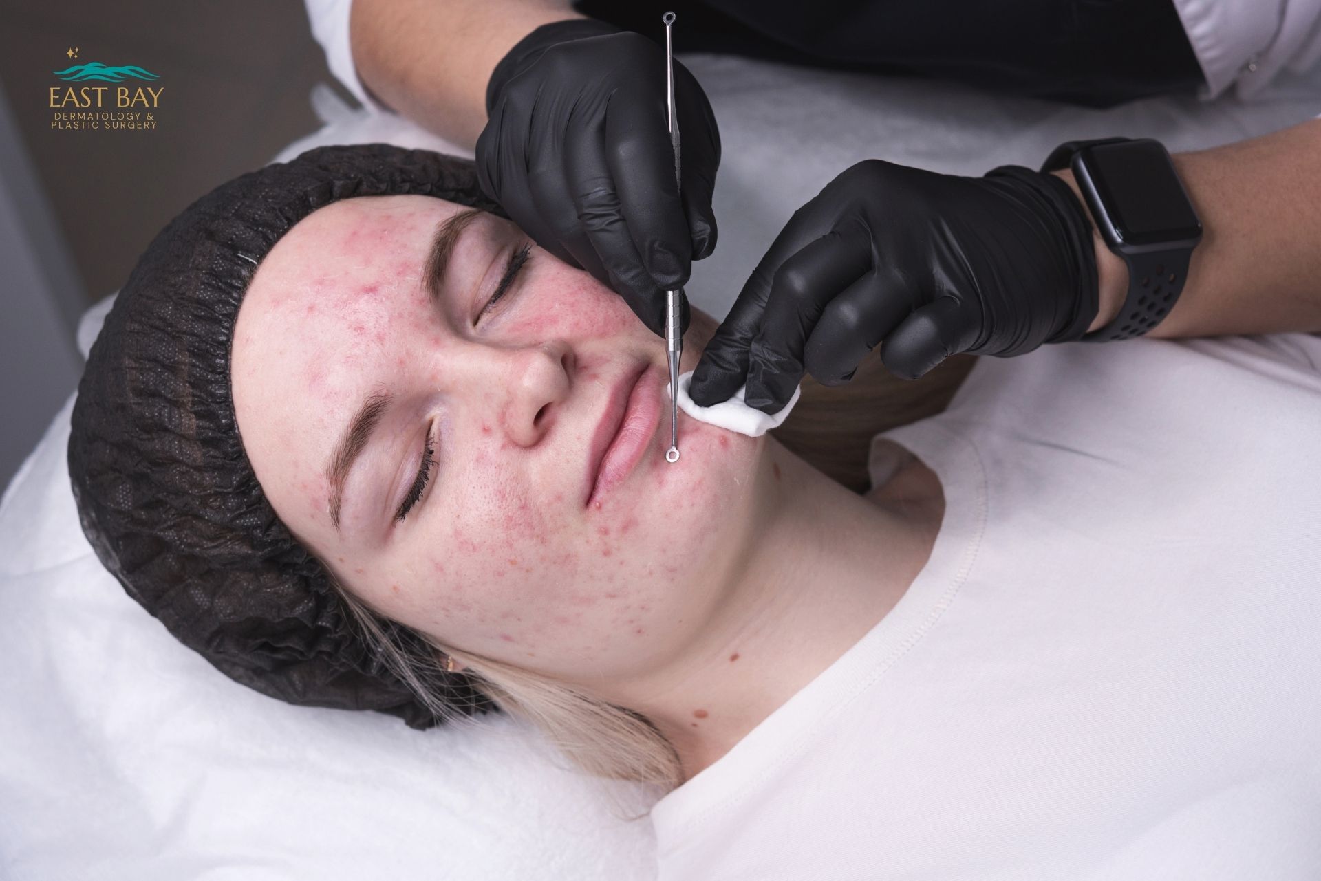 A woman getting her eyebrows examined by a doctor