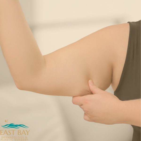 A person pinching loose skin or excess fat on the underside of their upper arm, illustrating a potential need for Arm Lift Lipo. The East Bay Dermatology & Plastic Surgery logo is visible in the corner.
