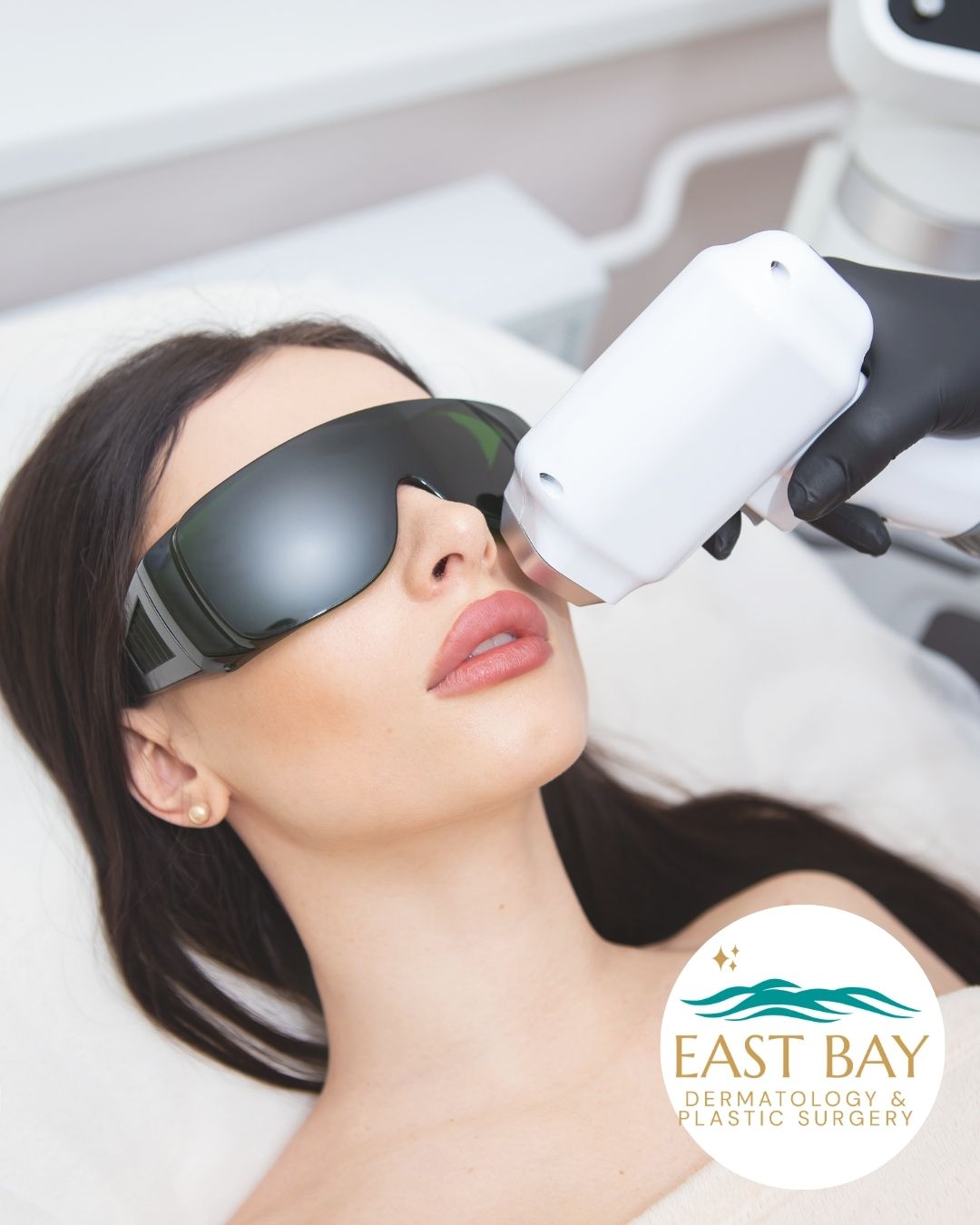 A woman wearing protective goggles receives a cosmetic laser treatment on her face. East Bay Dermatology & Plastic Surgery logo is visible in the corner.