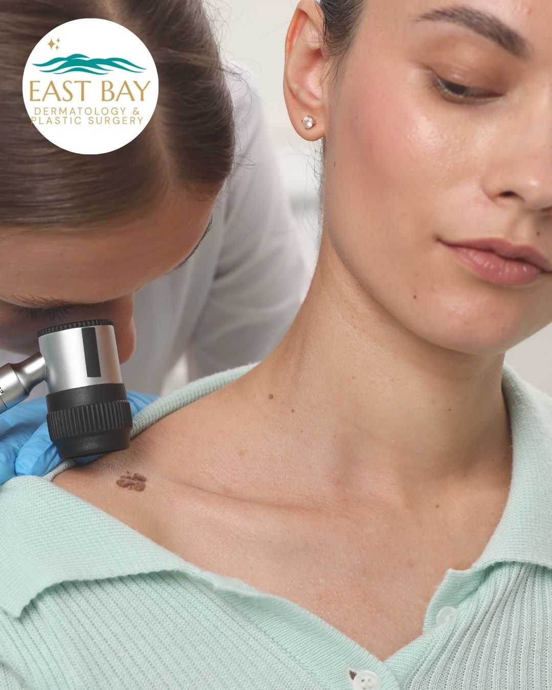 A dermatologist examines a mole on a woman's shoulder with a dermatoscope, highlighting the importance of early skin cancer treatment. East Bay Dermatology & Plastic Surgery logo appears in the upper left corner.