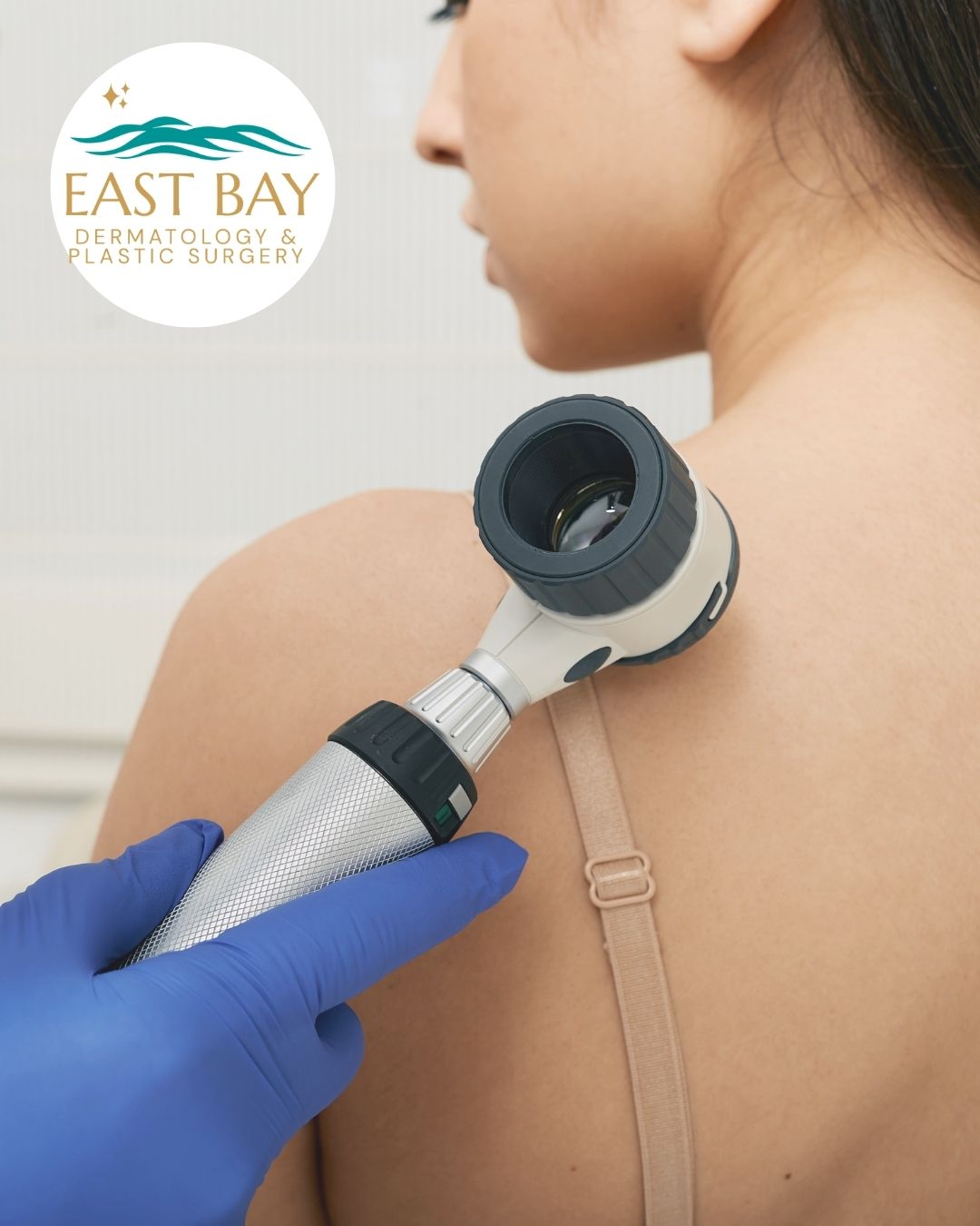 Skin cancer treatment in Merrick NY at East Bay Dermatology