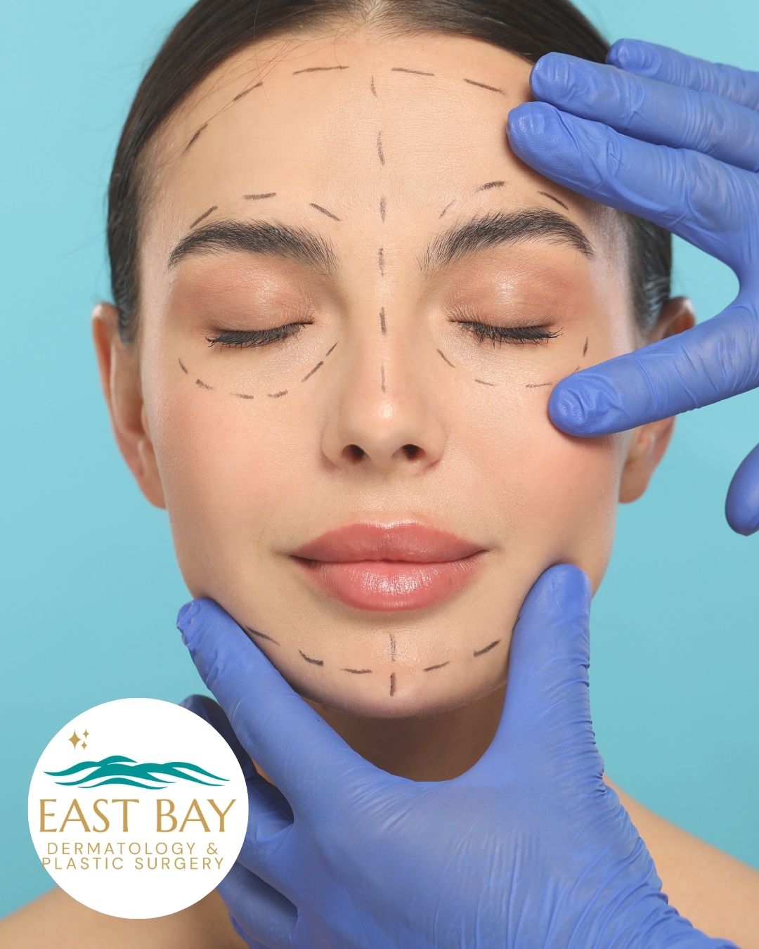 A woman with surgical lines drawn on her face is gently held by gloved hands; "East Bay Dermatology & Plastic Surgery" logo is in the corner.