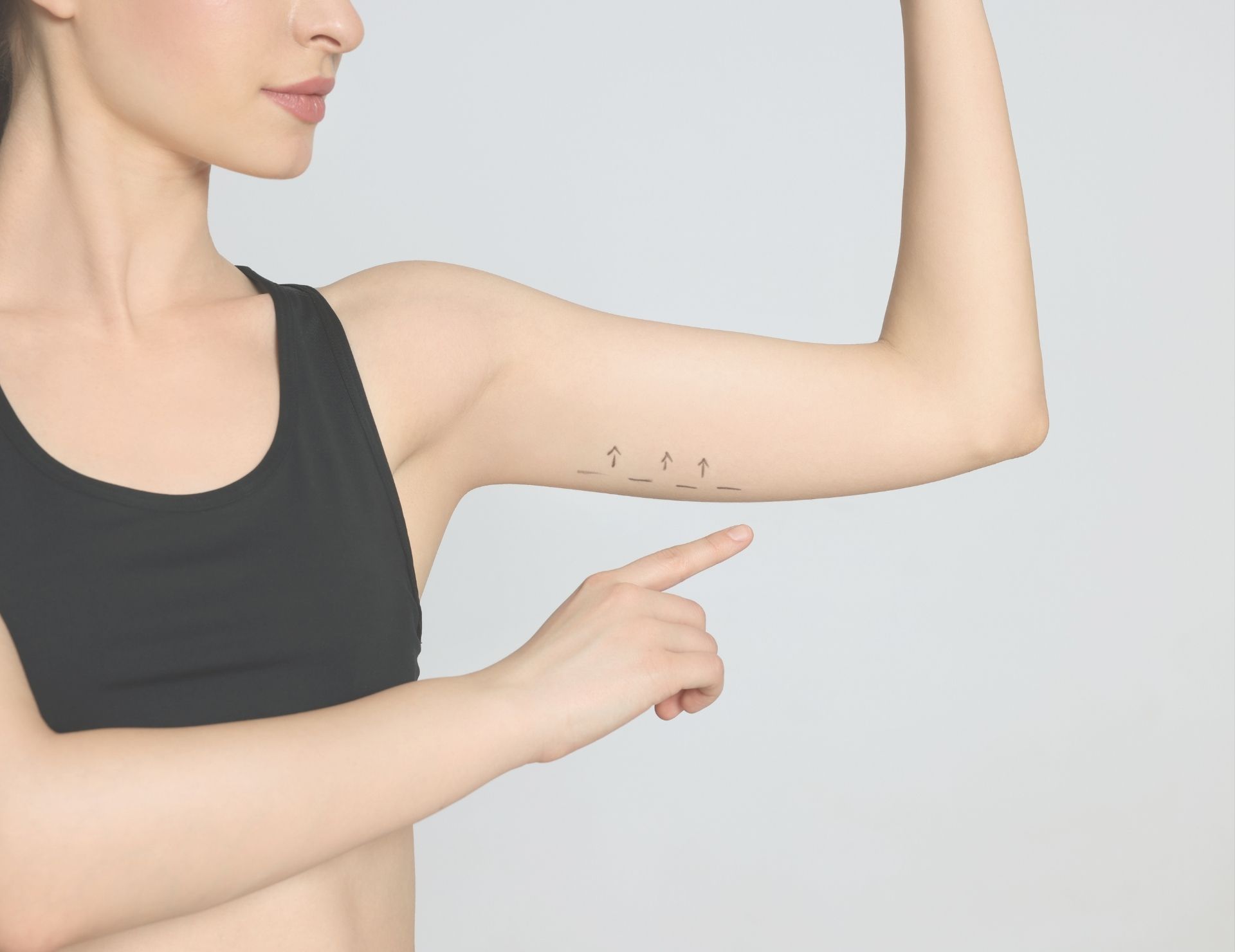 Woman in a black sports bra flexing her arm, pointing to her upper arm where black arrows and lines are drawn on the skin, suggesting areas often considered for surgical treatments.