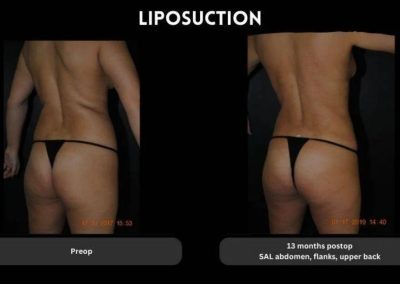 A collage of a woman's body.