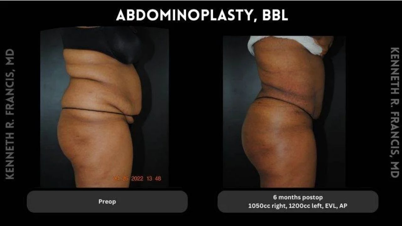 A comparison of a woman's body.