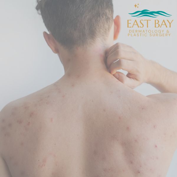 Skin condition evaluation for eczema and psoriasis at Long Island dermatology practice
