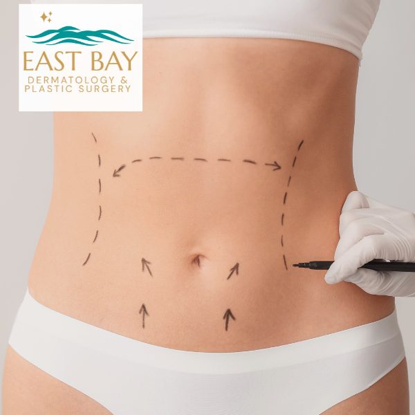 body lift bellmore east bay dermatology and plastic surgery