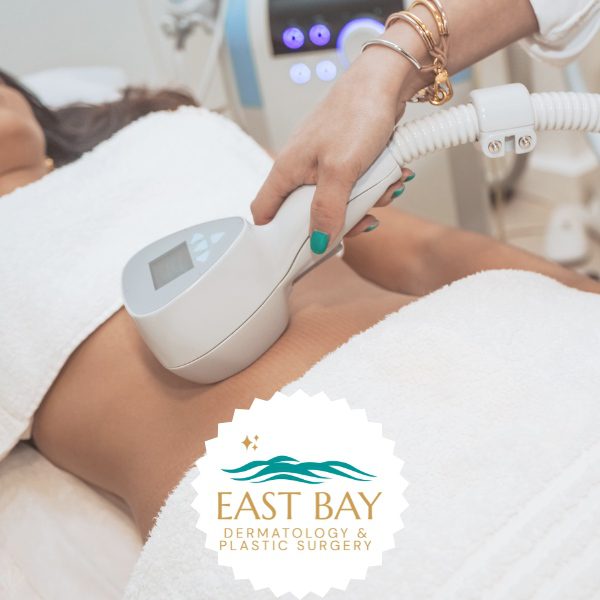 coolsculpting in bellmore ny