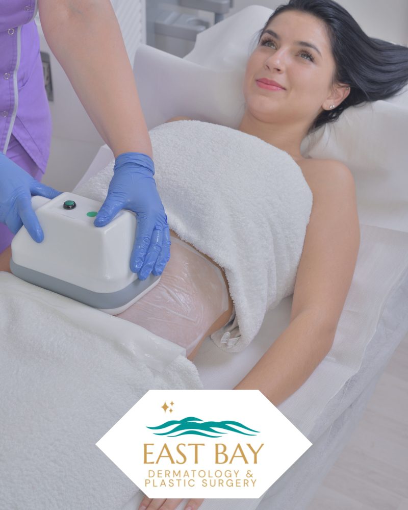 coolsculpting bellmore ny