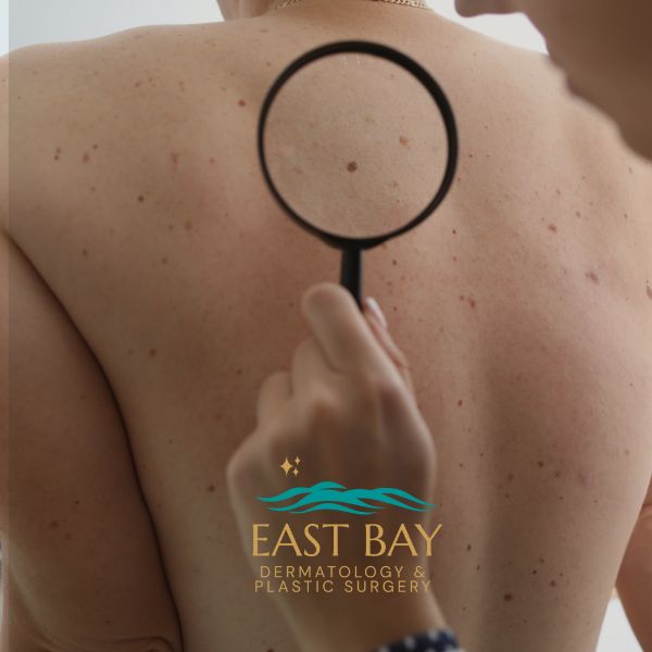dermatologist on long island east bay derm (1)