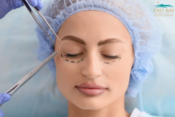 Woman with closed eyes and surgical markings under her eyes, wearing a blue hair cap, as a medical professional holds surgical instruments near her face.