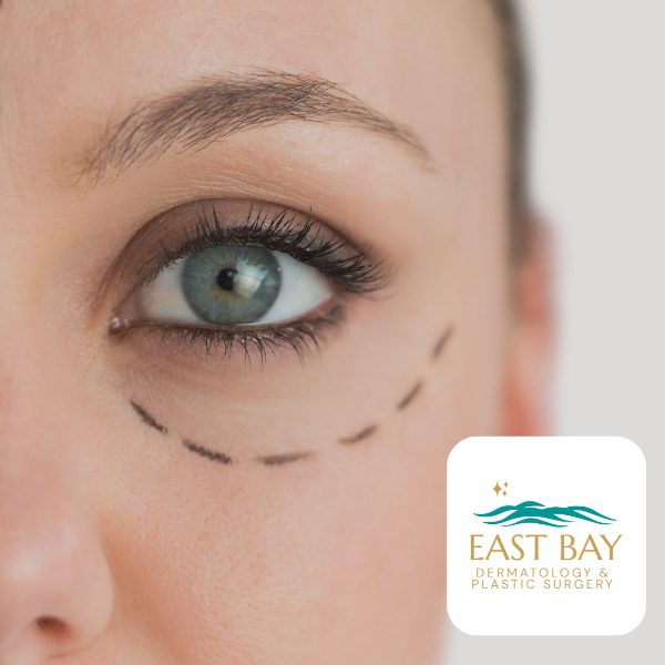 facelift surgeon in seaford new york east bay derm 