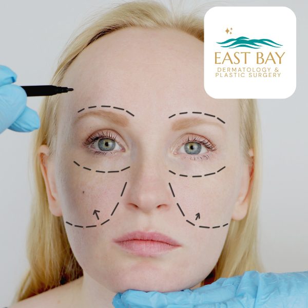 facelift surgeon in seaford east bay derm