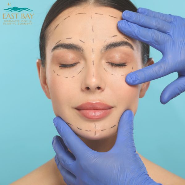 A woman with closed eyes has pre-surgery markings on her face as gloved hands gently touch her chin and cheek. Logo for East Bay Dermatology & Plastic Surgery is visible.