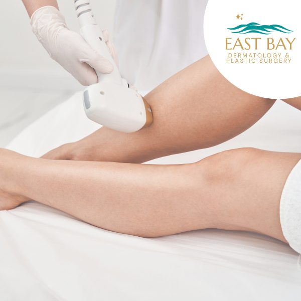 laser hair removal bellmore ny