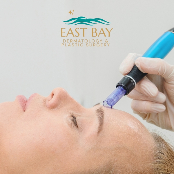 microneedling in bellmore ny 