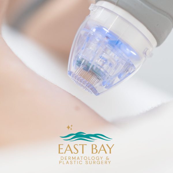 microneedling in bellmore ny